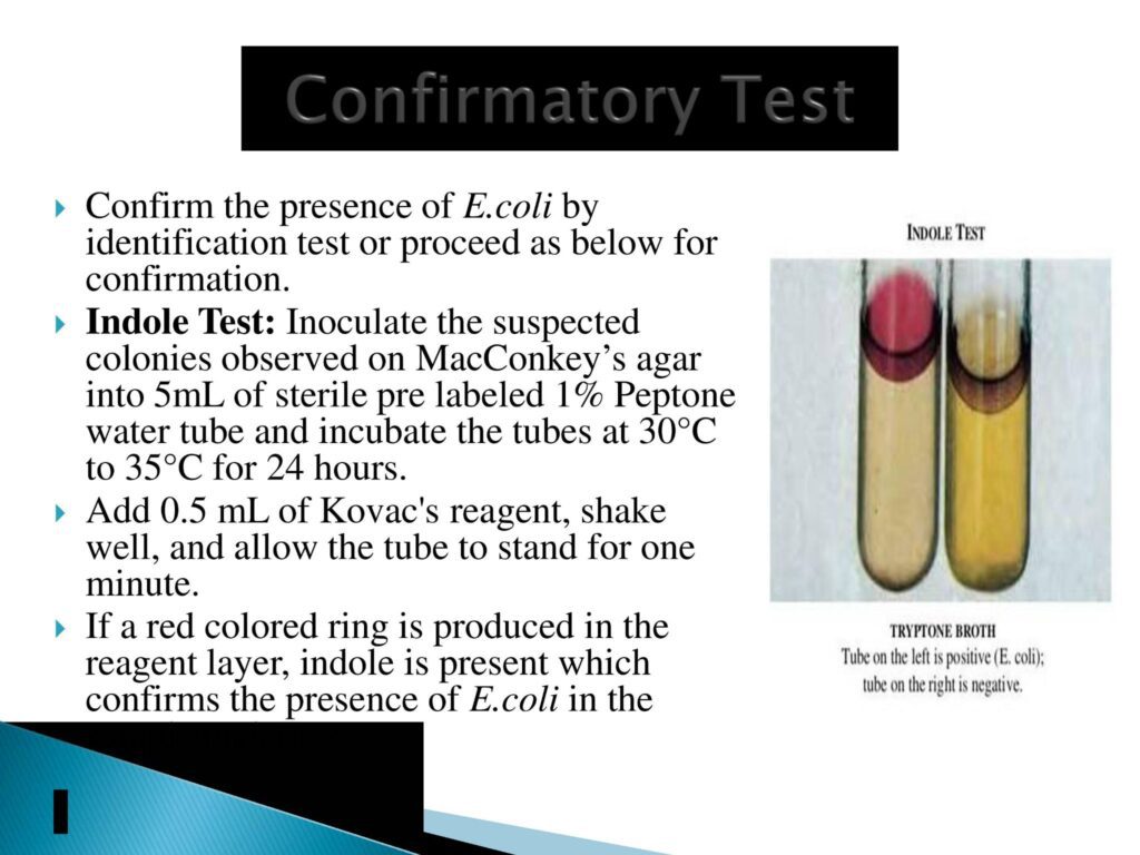 Microbial Limit Test: